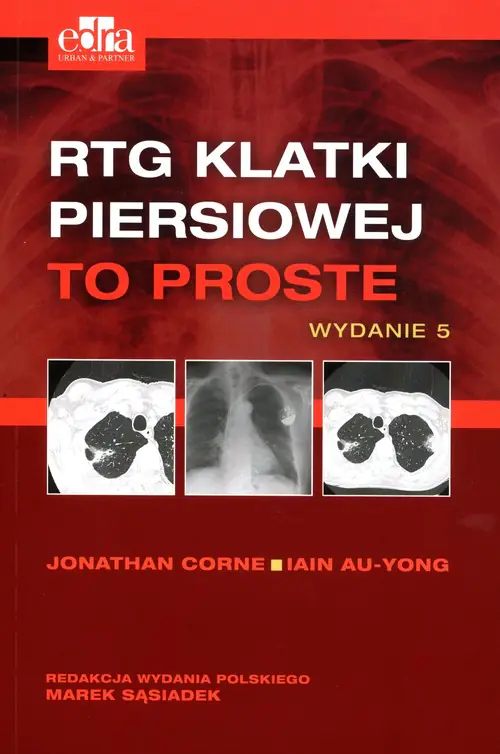 Książka - RTG klatki piersiowej