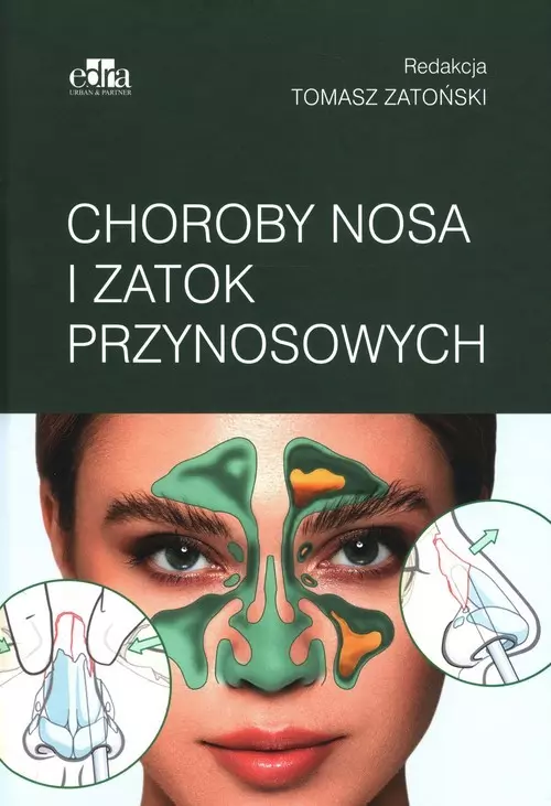 Książka - Choroby nosa i zatok przynosowych