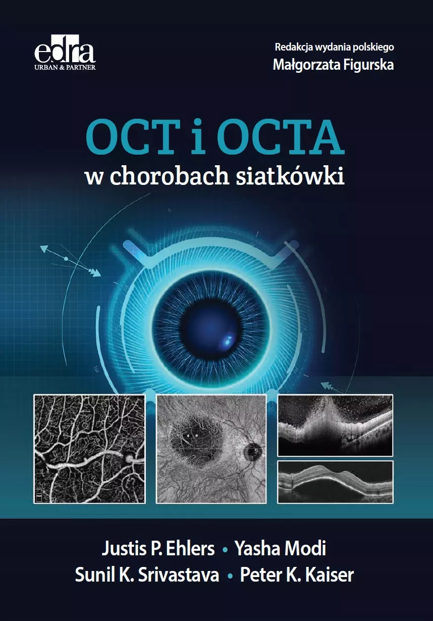 Książka - OCT i OCTA w chorobach siatkówki