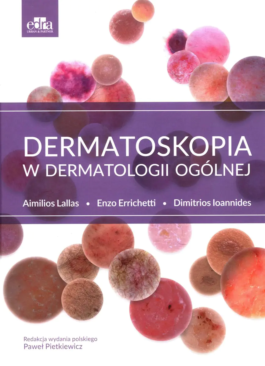 Książka - Dermatoskopia w dermatologii ogólnej