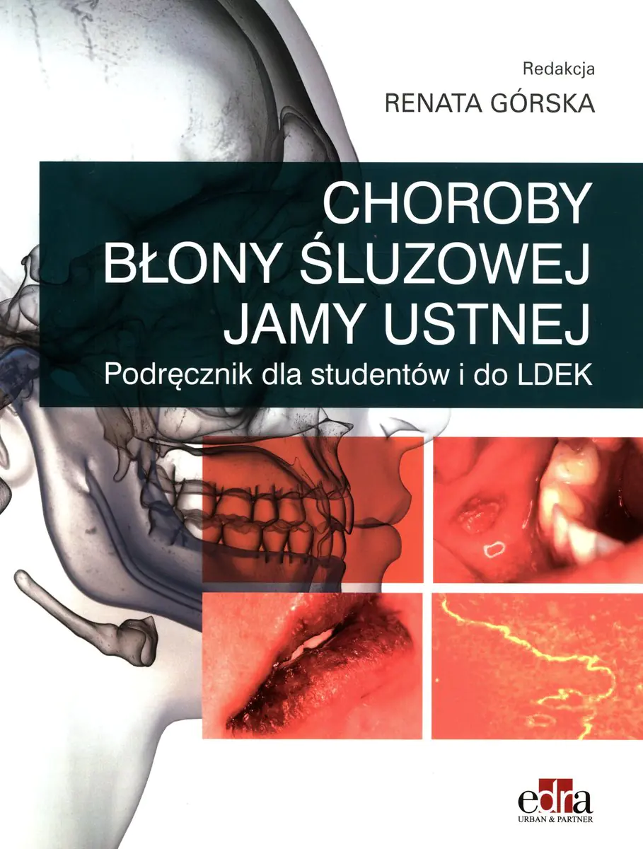 Książka - Choroby błony śluzowej jamy ustnej