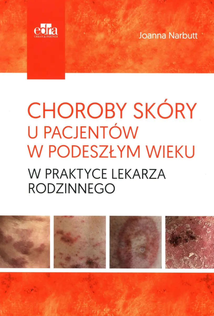 Książka - Choroby skóry u pacjentów w podeszłym wieku w praktyce lekarza rodzinnego