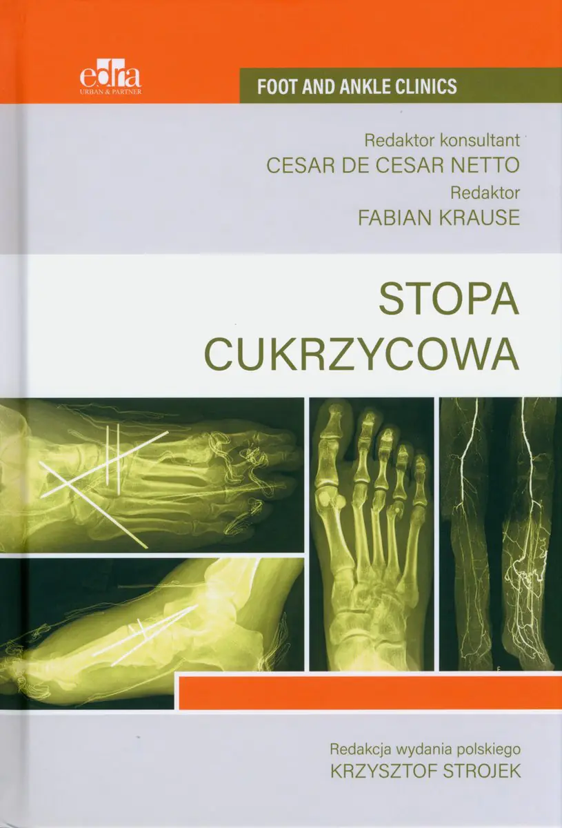 Książka - Stopa cukrzycowa