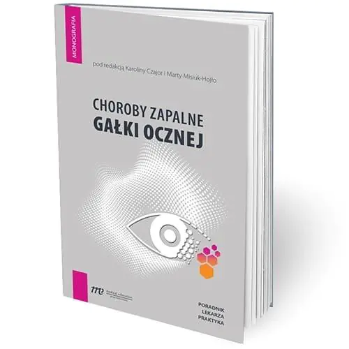 Książka - Choroby zapalne gałki ocznej - poradnik lekarza praktyka