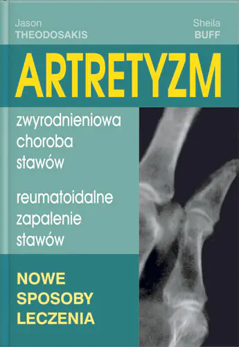 Książka - Artretyzm