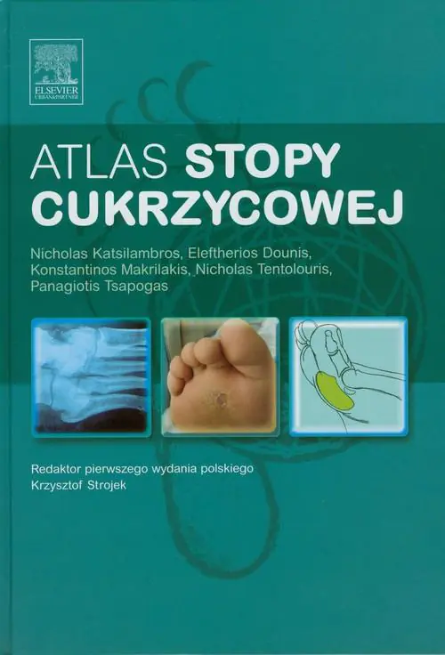 Książka - Atlas stopy cukrzycowej