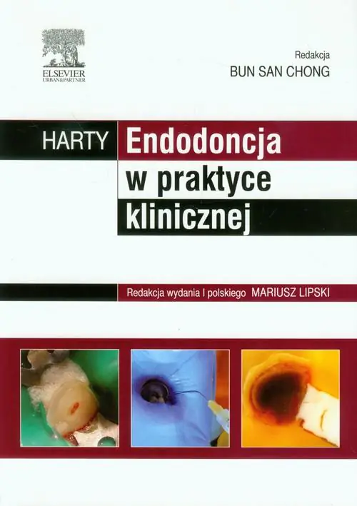 Książka - HARTY. Endodoncja w praktyce klinicznej