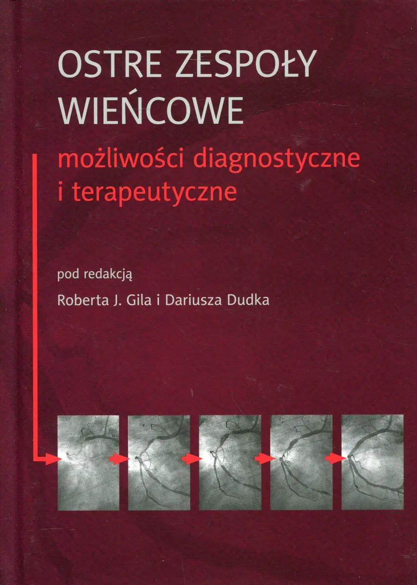 Książka - Ostre zespoły wieńcowe, możliwości...