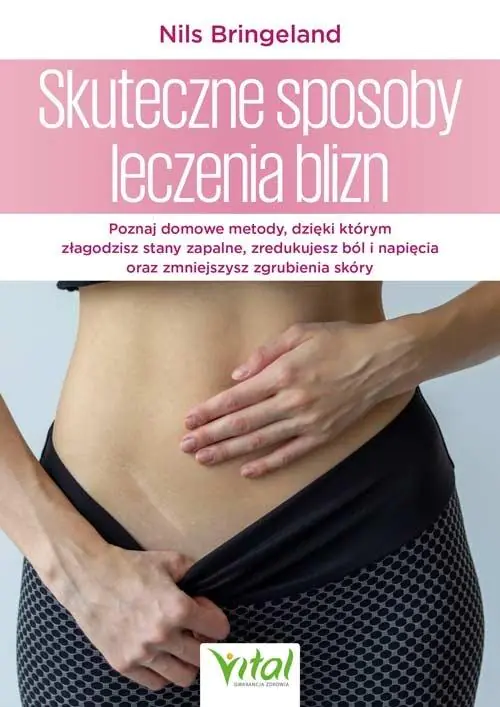 Książka - Skuteczne sposoby leczenia blizn