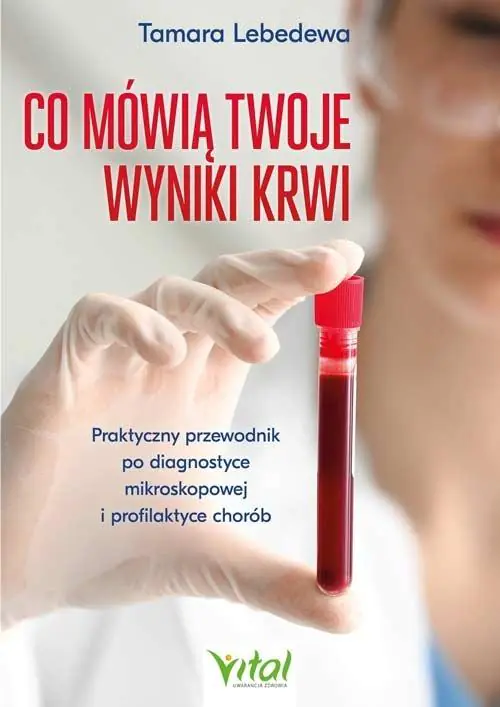 Książka - Co mówią twoje wyniki krwi. Praktyczny przewodnik po diagnostyce mikroskopowej i profilaktyce chorób