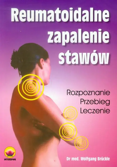 Książka - Reumatoidalne zapalenie stawów