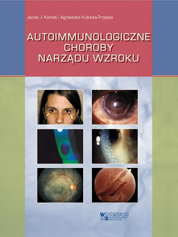 Książka - Autoimmunologiczne choroby narządu wzroku