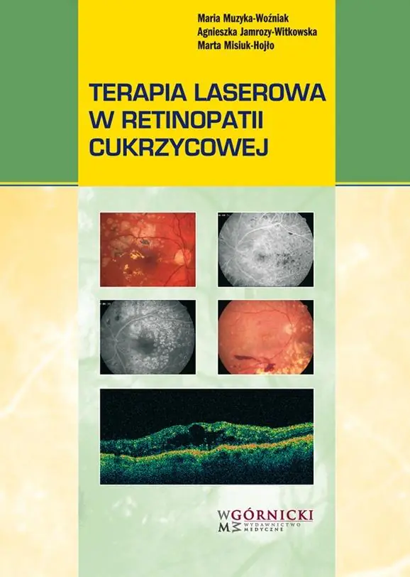 Książka - Terapia laserowa w retinopatii cukrzycowej