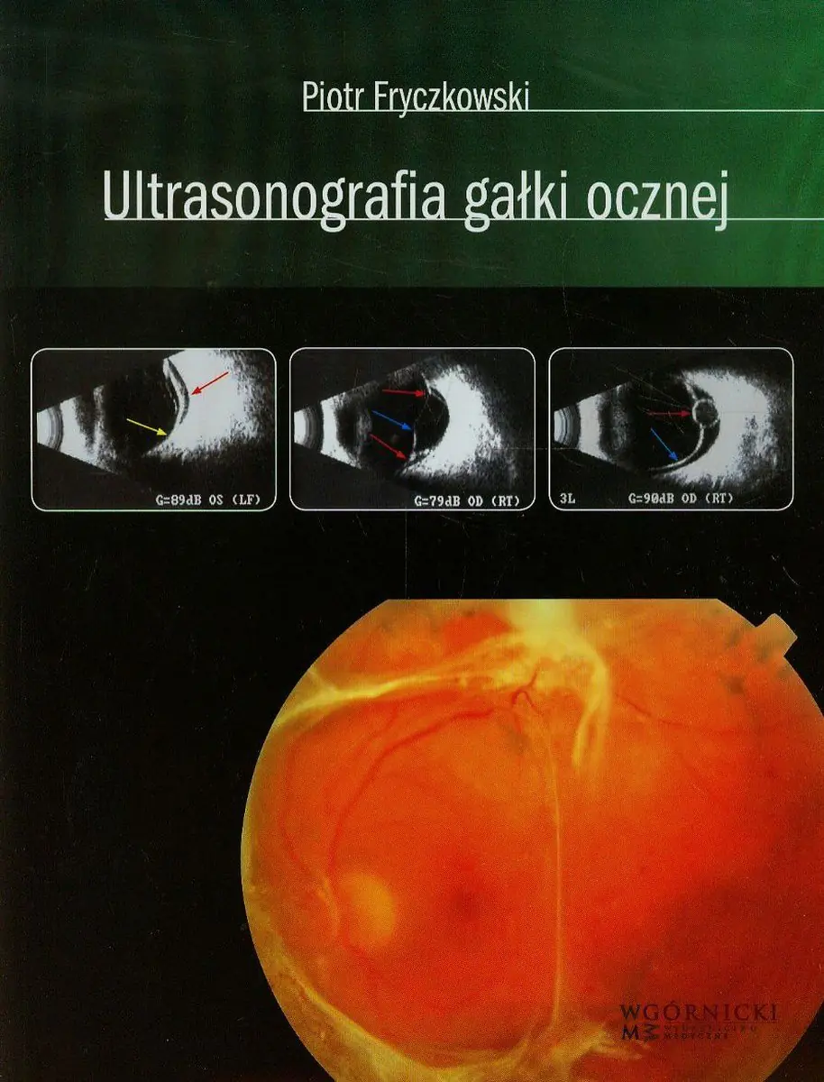 Książka - Ultrasonografia gałki ocznej