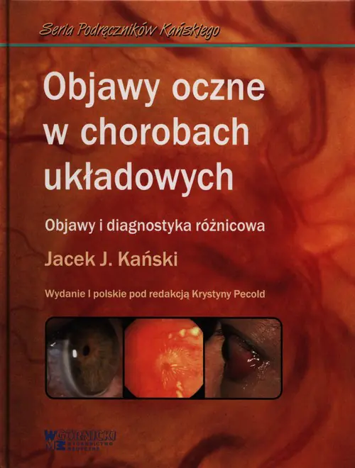 Książka - Objawy oczne w chorobach układowych