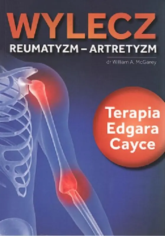 Książka - Wylecz reumatyzm - artretyzm. Terapia Edgara Cayce