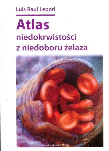 Książka - Atlas niedokrwistości z niedoboru żelaza